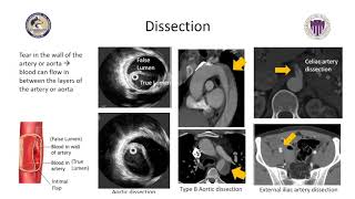 The Art of VEDS Vascular Surgery: Critical Questions Answered (August 27, 2020) E3 Summit