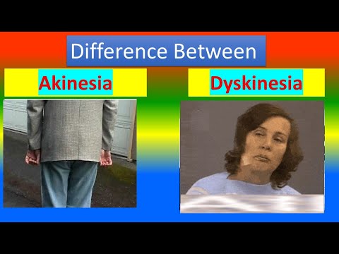 What is akinetic crisis?