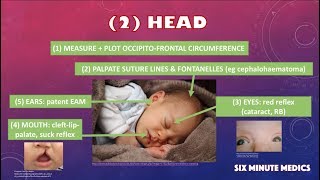 Newborn Exam OSCE - Overview in 6 minutes