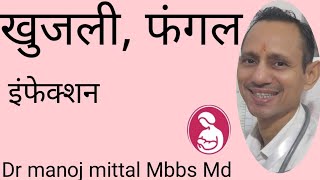 खारिश खुजली का जड़ से best treatment देखिये इसकी smart video में, Dr Manoj mittal Mbbs Md,