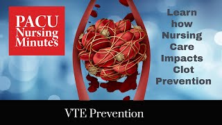 VTE Prevention, How Nursing Care impacts clot prevention.