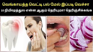 இயற்கையாகவே பல் வலியை சரிசெய்ய 5 வழிகள் |  Home Remedies  to Relieve Tooth Pain Naturally in tamil