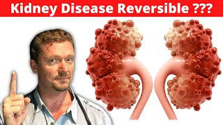 Reverse Chronic Kidney Disease (CKD) [Improve Kidney Function with Diet] 2024