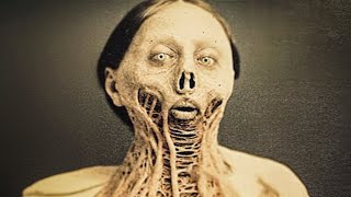 11 Most TERRIFYING Diseases In History