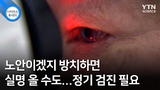 노안이겠지 방치하면 실명 올 수도...정기 검진 필요 / YTN 사이언스