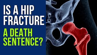 Is a Hip Fracture a Death Sentence?