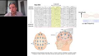 The Self-Tuning Brain: Normalizing Brain Oscillations with Neurofeedback