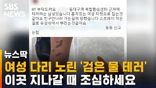 동대구역서 잇단 '검은 액체 테러'…여성 다리 노린다 / SBS / 뉴스딱