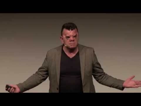 Own your face | Robert Hoge | TEDxSouthBank Own your face | Robert Hoge | TEDxSouthBank