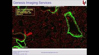 Second Harmonic Generation: Imaging and Quantification of Idiopathic Pulmonary Fibrosis of the Lung