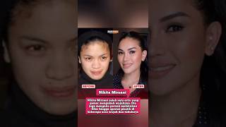 Dari Sarwendah hingga Gisel, Begini Penampakan Before After Artis Filler Dagu #nikitamirzani #viral