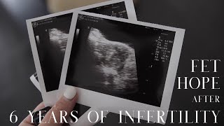The PERFECT Frozen Embryo Transfer Day! (IVF FET) | Infertility & Gestational Surrogacy Journey