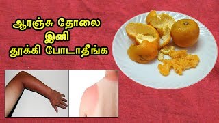 Sun tan removal using orange peel / ஆரஞ்சு தோலை பயன்படுத்தி வெய்யலால்  வரும் கருமை நீக்க எளிய வழி