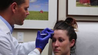 Botox For Migraines