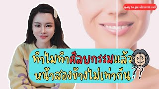 ทำไมทำศัลยกรรมแล้วหน้าสองข้างไม่เท่ากัน ?!