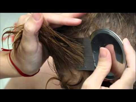 Bug Bites: Scabies, Lice & Bedbugs Bug Bites: Scabies, Lice & Bedbugs