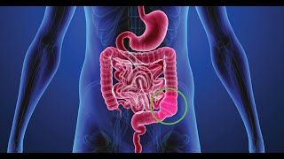 The Basics: Constipation | WebMD