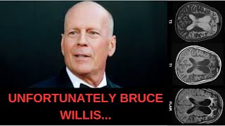 How Bruce Willis' Shocking Diagnosis Reveals Surprising Truth About Frontotemporal Dementia!