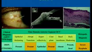 AIOC2018 - Free Paper - Ocular pathology - Key Note - Dr.Rath Suryasnata