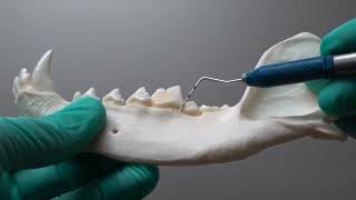Where do we make an incision?