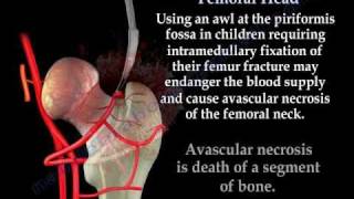 Avascular Necrosis, Blood Supply Femoral Head- Everything You Need To Know - Dr. Nabil Ebraheim