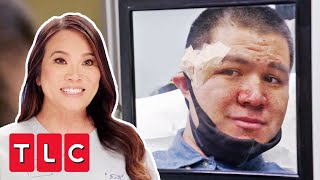 Dr Lee Helps Young Man With Tuberous Sclerosis Gain More Confidence | Dr Pimple Popper: Pop-Ups