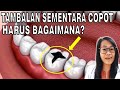 Tambalan gigi sementara lepas, padahal belum waktunya kontrol | Harus bagaimana?