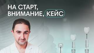 Клинический кейс. Давид Назарян.