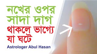 নখে সাদা দাগ থাকলে আপনার ভাগ্যে যা ঘটে ! সকলের  জানা জরুরী!