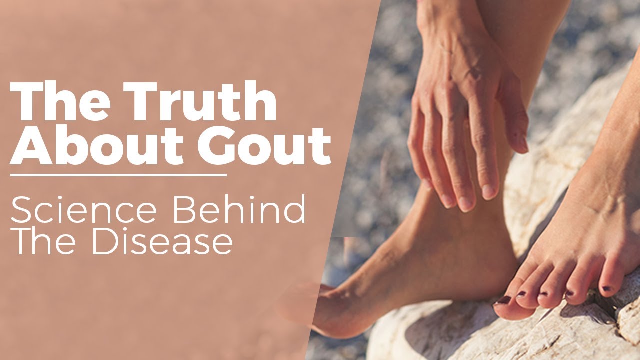 The Truth About Gout – Science Behind The Disease - YouTube