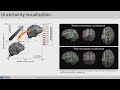 OHBM 2022 | 2597 | Symposium | Laura Marzetti | Multimodal connectomics for personalized neurostim…