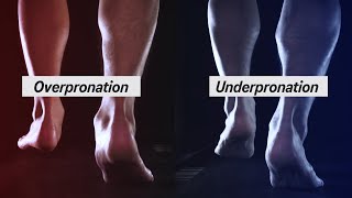 How to Determine your Pronation