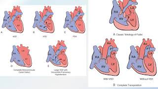 heart diseases : practical aspect