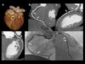 mmstvl44aaac ரமலான் நோன்பு மருத்துவ ஆலோசனை ra migraine renal calculi gout chest pain high bp