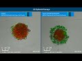 Monitoring and Quantifying 3D Tumor Spheroid Drug Cytotox by RTCA eSight Live Cell Analysis System