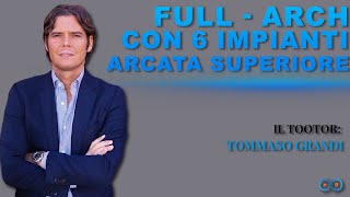 Full-Arch con 6 impianti: arcata superiore