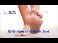 Early Signs of Diabetic Foot