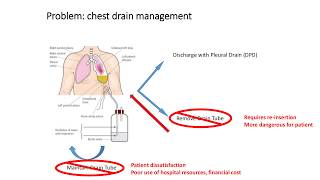 A Cost Skew Aware Predictive System for Chest Drain Management