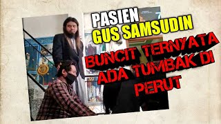 PASIEN GUS SAMSUDIN SEMBUH SETELAH SAKIT PERUT MEMBESAR KENA SANTET