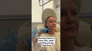 Massater BOTOX for teeth grinding  #botox #massater #teethgrinding #shorts