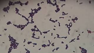 Gram staining of Enterococcus avium