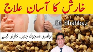 Treatment for scabies | خارش کا مکمل علاج جسم پر خارش کا علاج