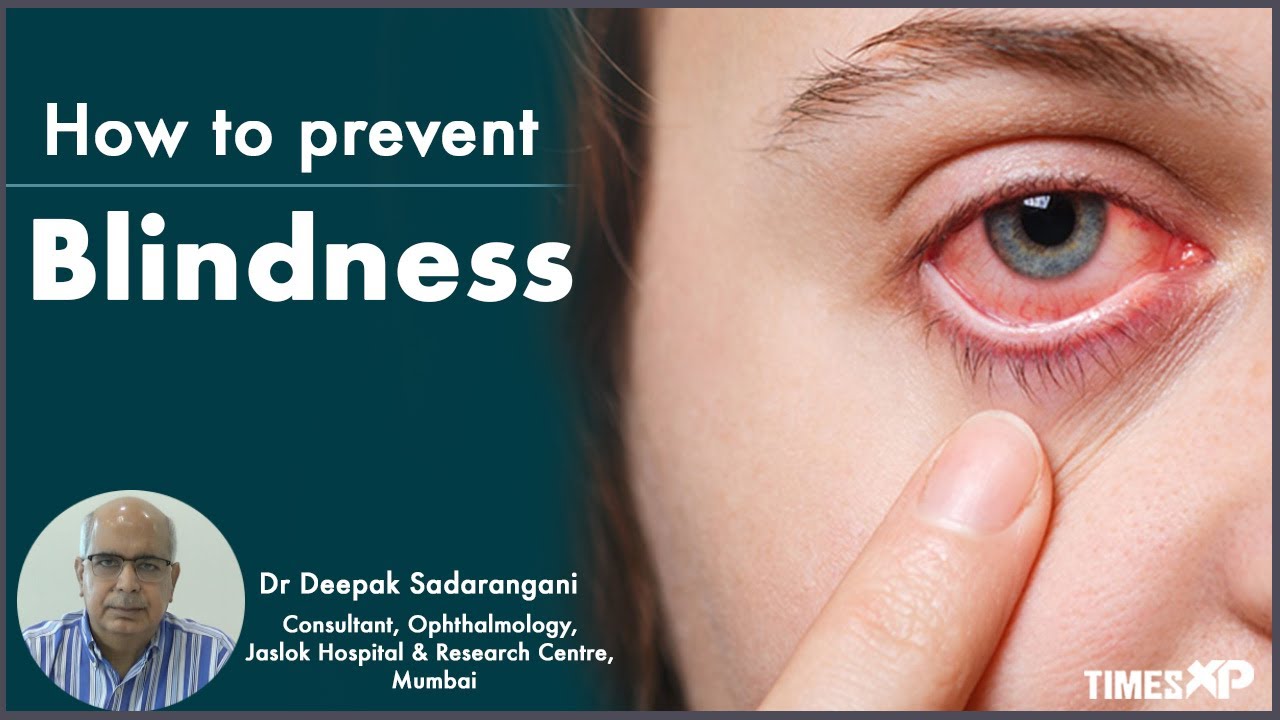 How To Prevent Diseases That Cause Blindness | How To Prevent Vision ...