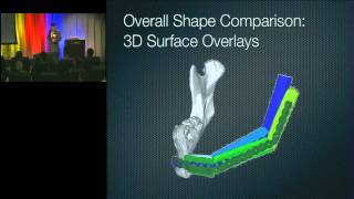 2011 Frontiers of Engineering: Additive Manufacturing is Changing Surgery