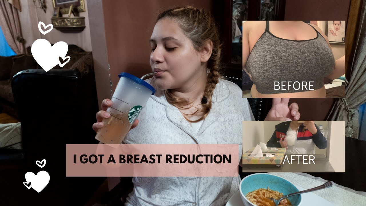 BREAST REDUCTION SURGERY VLOG! (Surgery Day) - YouTube