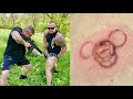 Ar-15 Barrel Burn Pain Experiment!!! (TheBellLife Bangs)  ￼