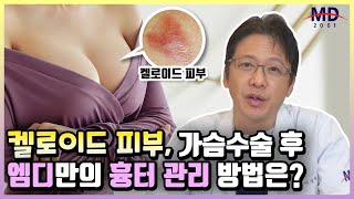 켈로이드 피부, 가슴수술 후 흉터에 대한 엠디만의 관리 방법이 있나요?