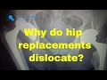 Why do hip replacements dislocate?