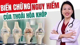 Biến Chứng Nguy Hiểm Của Thoái Hóa Khớp | Bác sĩ Trang