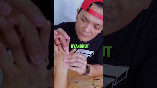 Cara melepas cincin yang nyangkut di jari #lifehacks